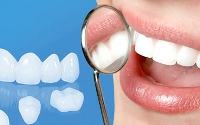 Top 9 thực phẩm làm trắng răng cực hiệu quả